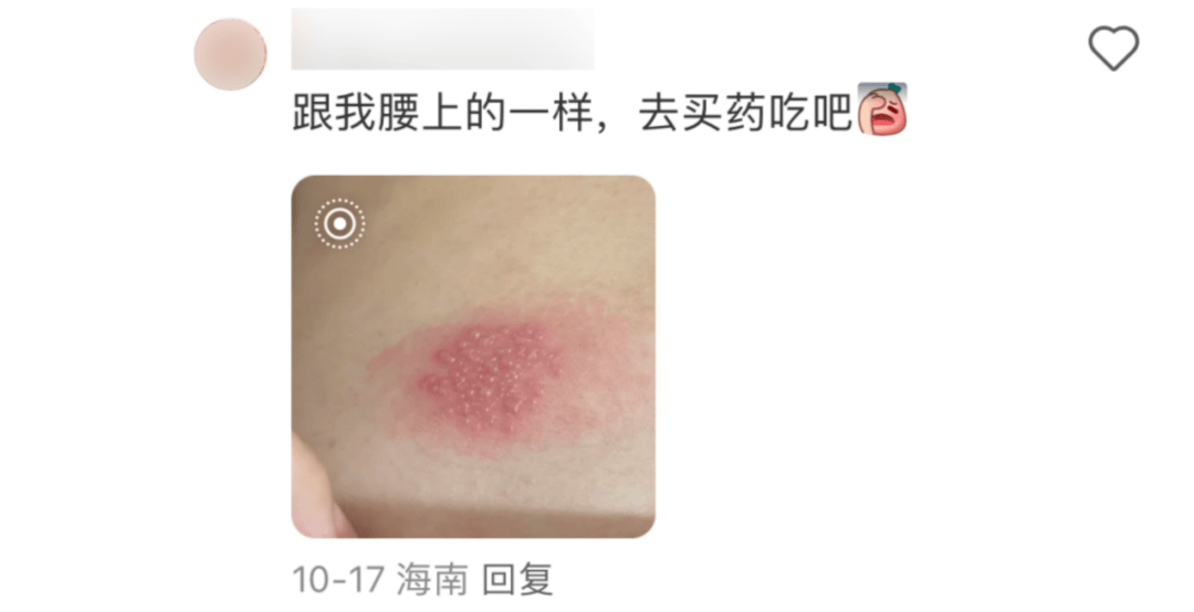 一旦感染终身携带<strong></p>
<p>集合理财</strong>！深圳疾控提醒：这4类人要注意