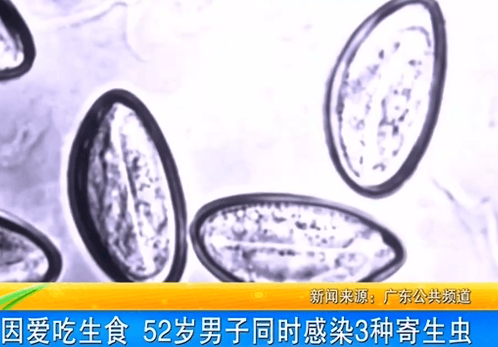 女子体内排出10米长绦虫<strong></p>
<p>如何理财规划</strong>！原是两年前旅游时吃了这种食物