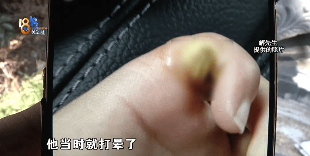 5岁男童瞬间晕厥<strong></p>
<p>公司理财答案</strong>，筋都断了！街上常见，看见立即远离