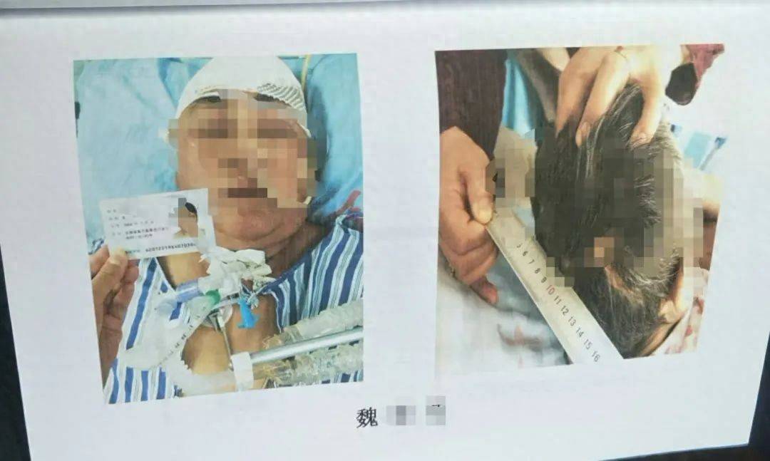 目睹母亲过马路被车撞<strong></p>
<p>立马理财</strong>，27岁女子受惊吓5天后身亡