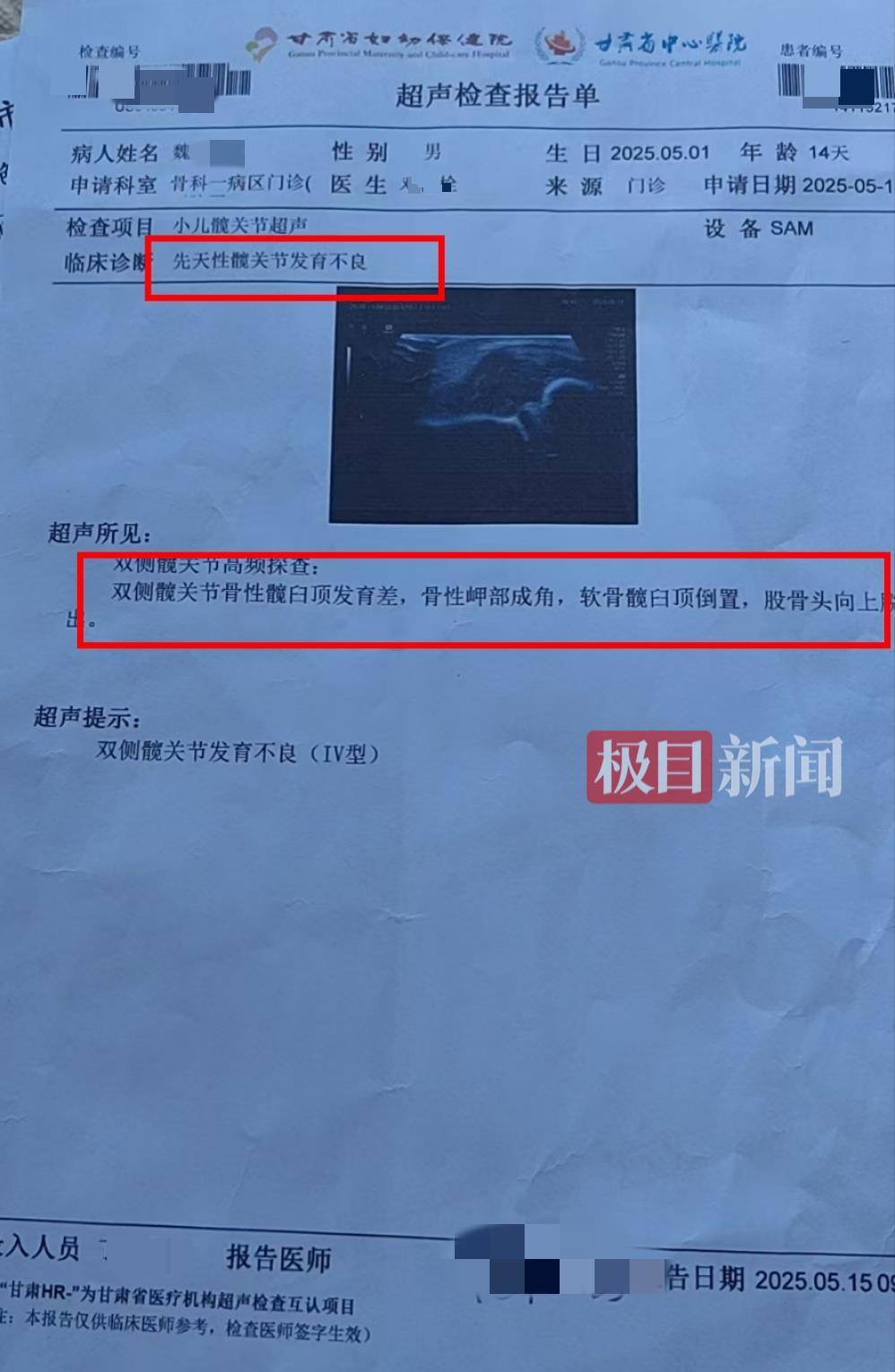 二胎出生查出先天性病症或落下残疾<strong></p>
<p>米庄理财</strong>，残疾父母称医院产检漏检、未尽告知义务，医院及医调委回应