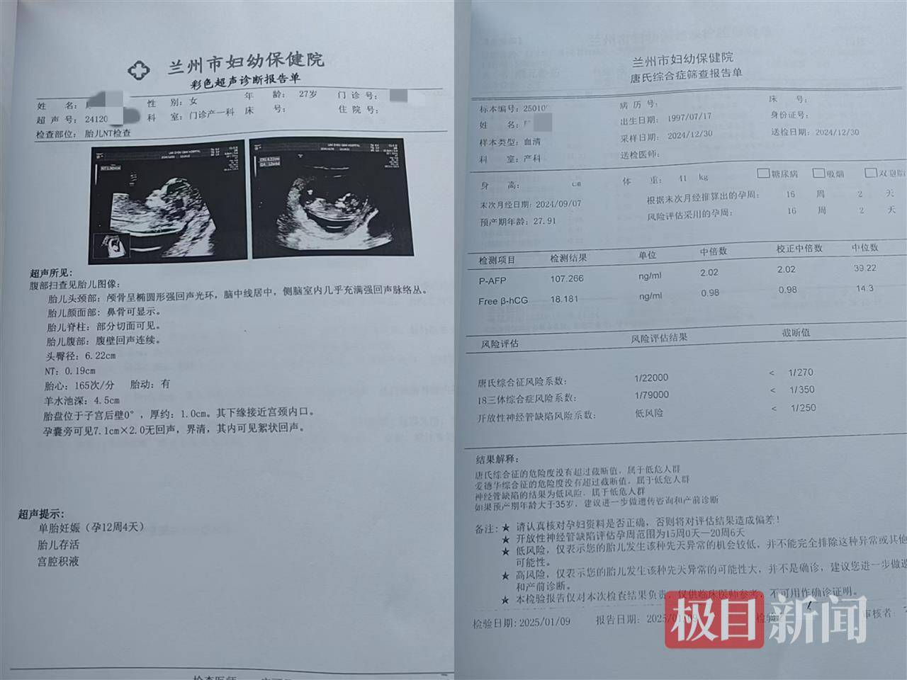 二胎出生查出先天性病症或落下残疾<strong></p>
<p>米庄理财</strong>，残疾父母称医院产检漏检、未尽告知义务，医院及医调委回应