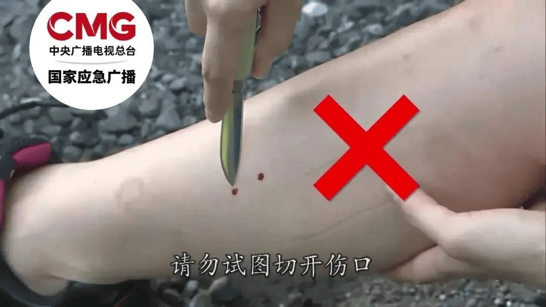 游客三亚疑被蛇咬身亡<strong></p>
<p>米庄理财</strong>，当地曾公布3家医院有抗蛇毒血清