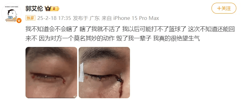 31岁郭艾伦直言想回国家队<strong></p>
<p>香港理财产品</strong>，但应该没什么机会了，此前眼睛被队友误伤，缝了40多针