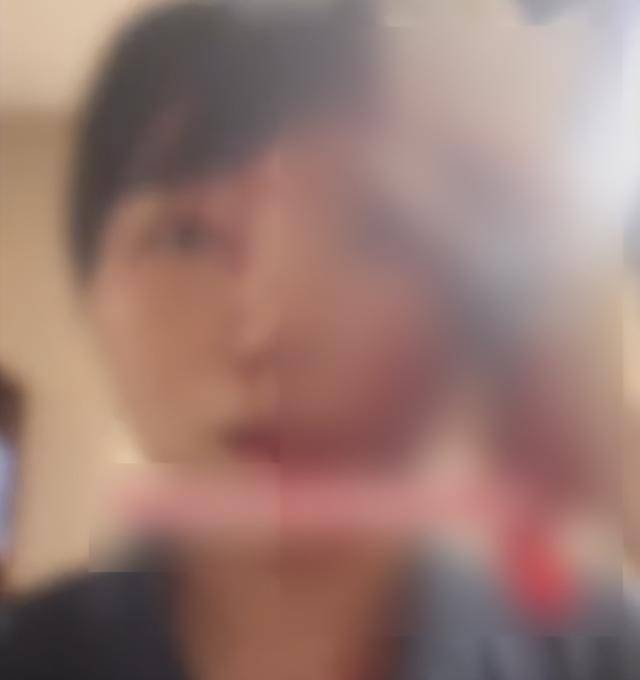 缝了20多针！女子称被不知名男同事砸头毁容<strong></p>
<p>菜鸟理财</strong>，警方介入