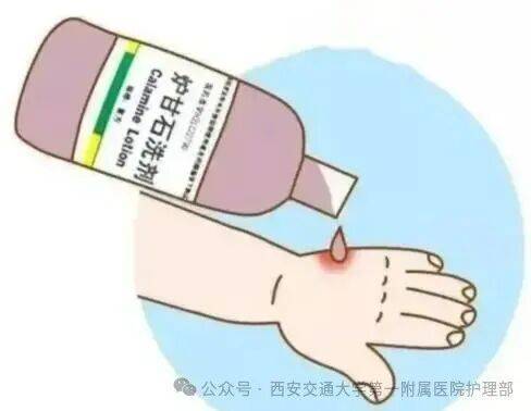 西安多区发现隐翅虫？千万别拍<strong></p>
<p>虚拟币TLS-1</strong>！毒液堪比硫酸