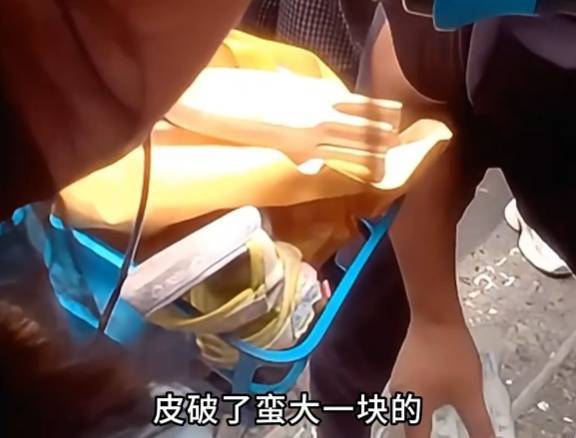 看着都疼<strong></p>
<p>虚拟币平台风控了咋办</strong>！上海街头一男子突然求助：10岁女儿被死死卡住！这个行为太危险→