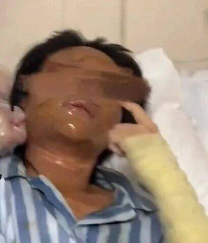 湖南一女主播被伪装的包裹炸伤<strong></p>
<p>虚拟币平台风控了咋办</strong>，永州公安：正在核实具体情况