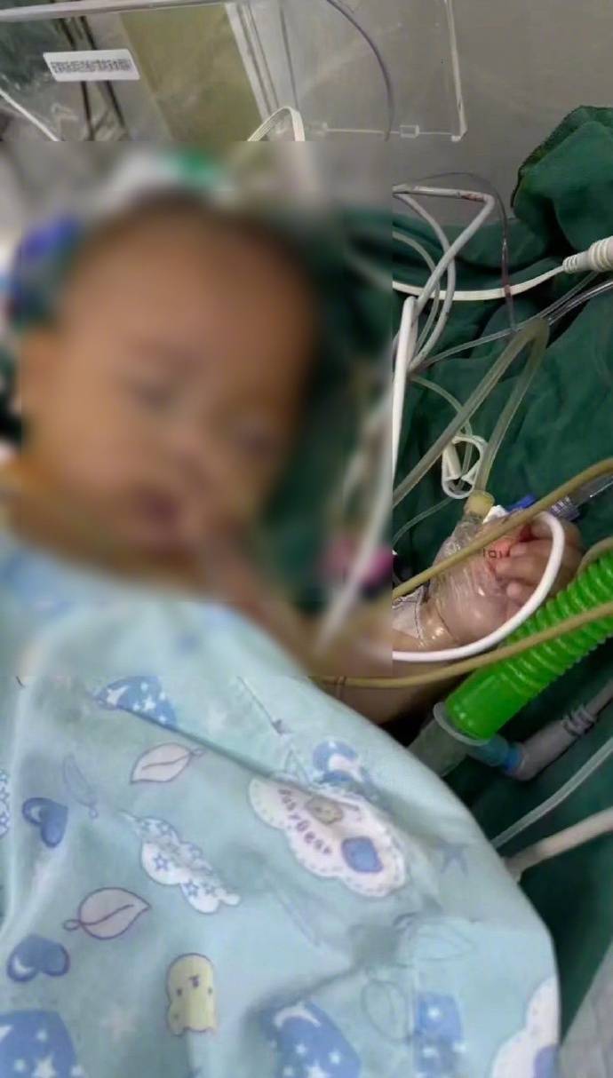 “小洛熙事件”涉事医院小儿胸心外科住院部已关闭<strong></p>
<p>XNB能不能赚钱</strong>，胸心外科手术已暂停