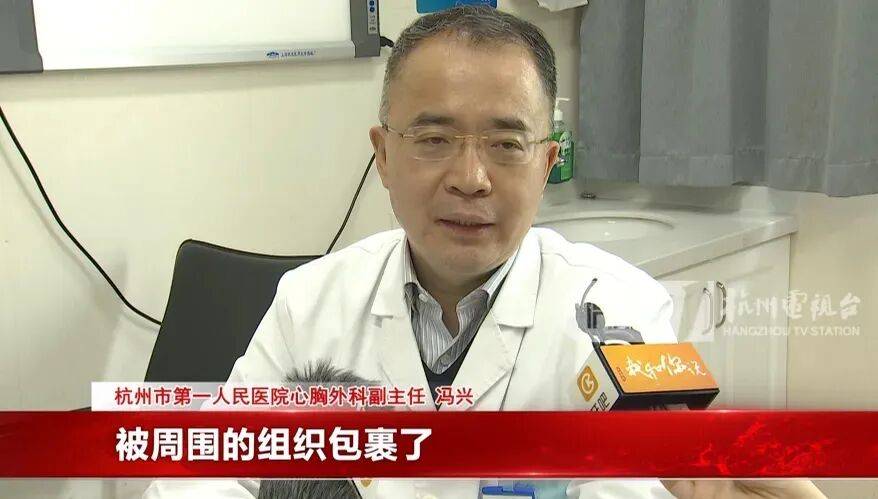 17岁小伙参军体检发现胸腔内有根5cm缝衣针<strong></p>
<p>虚拟币ACN是什么</strong>，父母回忆或是1岁时扎入，取出时已锈迹斑斑